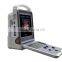 2016 newest handheld ultrasound machine color doppler