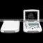 High Quality Medical ultrasound instruments Portable 10.4 inch Laptop Black and White Scanning Ultrasound