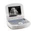 Full Digital black and white  laptop Doppler Diagnostic System ultrasound