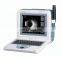 Portable A B Eye Test Ophthalmic Ultrasound Scanner with touch screen