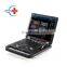 HC-A013A Cheap Price Medical Laptop Color Doppler Ultrasonic Diagnostic System Portable Color Doppler Ultrasound