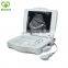MY-A004 Hospital Sonar Ultrasound Equipment Portable Ultrasound Machine