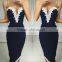 2015 new ladies banadage bodycon dress fashion design