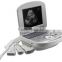 10.4 inch Portable Ultrasound Scanner RUS-2200 with battery 128 element Convex ,linear,Transvaginal ,micro-convex probe optional
