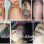 wholesale wanted portable laser sunburn spots removal machine price for age spot removal