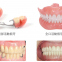 China dental lab denture  Dental lab China Dental lab Dental lab