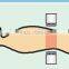 physical therapy bed RF-Capacitive Cancer Treatment Hyperthermia Machine