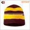 2015 High Quality oversized decorate knitted beanie hat