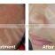 Facial Care LED PDT Led Red Light Therapy Machine Skin Rejuvenation Phototherapy Equipment Led Light Therapy For Skin