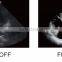 Chison hot selling portable 4d color doppler ultrasound Chison qbit 5