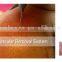 HF Spider Veins Removal Machine For Small vessels vascular veins on face, ear back, forehea