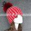 2017 New Trendy Winter Women Handmade Pompoms Cap Bobble Beanies Fur PomPom Hat