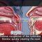 Medical Device for Allergic Rhinitis Acute Rhinitis Rhinitis