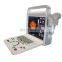 Portable Color Doppler Ultrasound System 15 inch 2d 3d 4d ultrasound Machine for hospital use