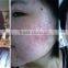 2016 New Product Skin Care Led Light for Facial Biofeedback LED Mask
