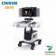 Chison hot selling portable 4d color doppler ultrasound Chison qbit 5