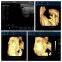 4D Color Doppler Ultrasound Scanner with Touch Screen
