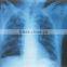 kodak x-ray filmx-ray film thermal dry film china hot film china classic hot film