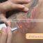 Q-switch nd yag laser machine prices erbium yag laser BS-TR6E