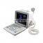 12 inch  Portable Full Digital 2D/3D/4D  Medical Ultrasound Instruments for Hospital use