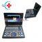 HC-A007 Factory Direct Medical Laptop portable Ultrasound scanner system ultrasound machine