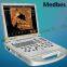 Portable 4D Color Doppler Ultrasound Scanner