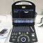 MY-A003B medical products laptop ultrasound b scan diagnostic ultrasound machine with probes