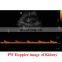 Original Mindray DP-20  ultrasound portable digital ultrasound system with super PW Doppler image