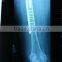 35*43cm Agfa films DT2B made in china for hospital agfa blue sensitive filmagfa x-ray film