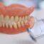 REMOVABLES | DENTURES Premier Denture  Dental Lab, Dental Implant, Crowns