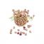 Hot sale speckled kidney beans large selected pinto bean