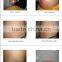 weight lose slimming machine Cryolipolysis Fat Freezen Slimming Equipment with high effects