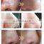 Hot selling 2020 hydra diamond microdermabrasion Aquasure H2 Blackhead Removal machine
