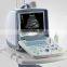15 inch LCD screen mobile 3D color doppler ultrasound machine