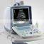 Portable Ultrasound Machine Price