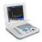 RUS-9000F2 CE Approved hot selling digital handheld ultrasound machine medical equipment-Shelly