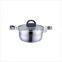 Top Hot Selling Kitchenware Stainless Steel Cookware Set