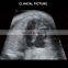 Latest Version Sonoscape P15 Trolley Color Ultrasound machine /cw color doppler ultrasound Sonoscape P15