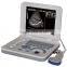 medical laptop sleek ultrasound scan machine cheapest ultrasound for vet