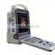2016 beautiful 3d/4d ultrasound color doppler scanner with fetus
