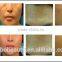 Wrinkle removal / Pinxel -2 Fractional RF with Micro needle Beauty Machine for Beauty Spa