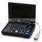 2015 New Laptop Ultrasound Scanner (PC System) on Sale