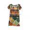 Loose fitting women casual dress 2015 summer trend