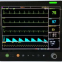 15 inch RX6800 multi-parameter patient monitor