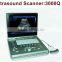best china supply Digital portable ultrasound scanner