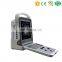 Newest MY-A025 Portable 4D Cardiac color doppler ultrasound scanner
