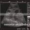 Sonostar portable cow ultrasound machine pig pregnancy ultrasound scanner pirce V5