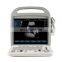 MY-A027D medical devices multi language 128 elements PW CW laptop color doppler portable ultrasound scanner machine with battery