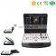 MY-A024A Medical 3D Color Doppler Ultrasound Machine Portable PC Ultrasound Scanner for SALE