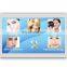 nd yag tattoo removal laser nail fungus treatment laser machine